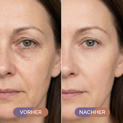 Novonell - Instant Awake Sofortstick